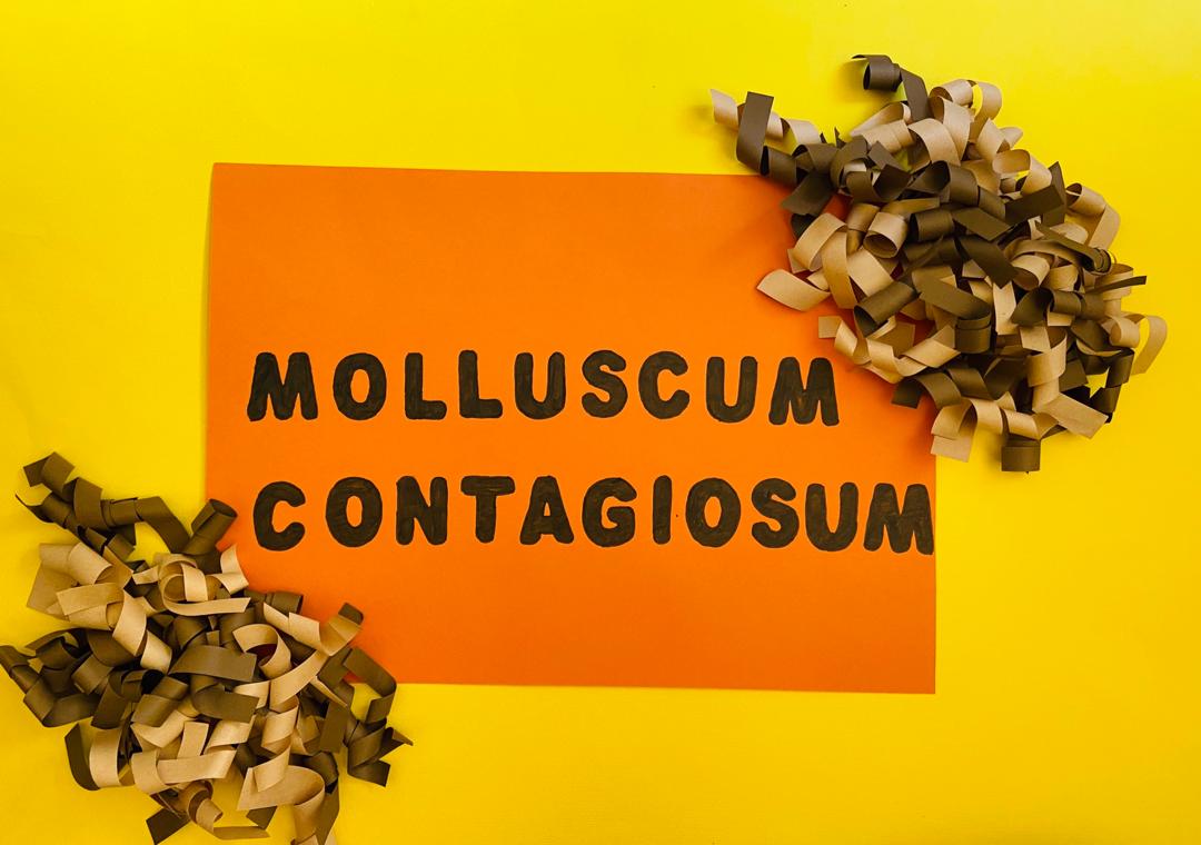 molluscum contagiosum 