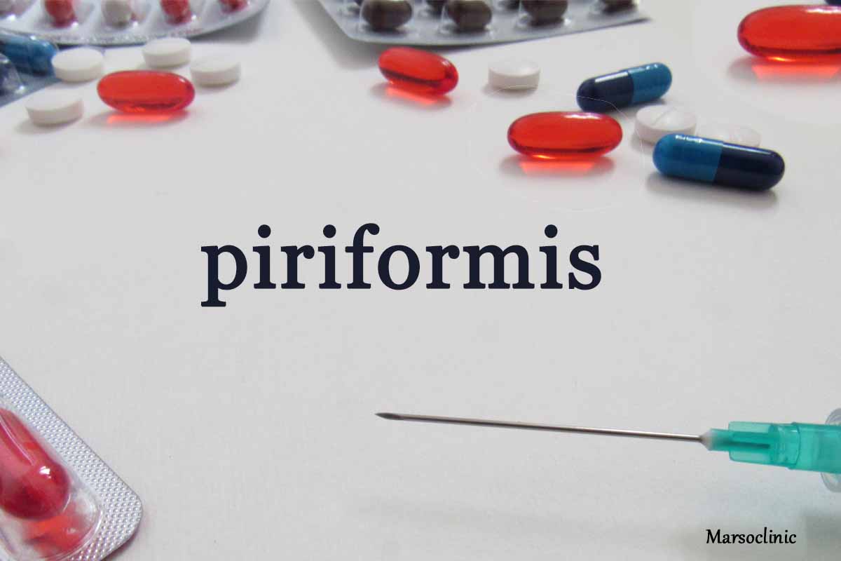 piriformis muscle