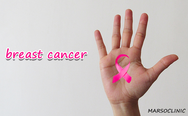 The major cause of breast cancer almost everyone ignores