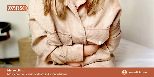 Most common cause of death in Crohn's disease